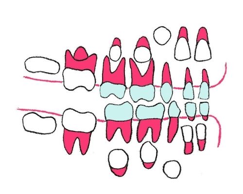 disegno colorato che mostra lo schema dell'eruzione dei denti da latte
